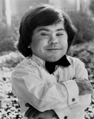 Herve Villechaize và Cuộc Tranh Luật Chẳng Nào Khác Nảy Sinh Từ Chiều Cao!